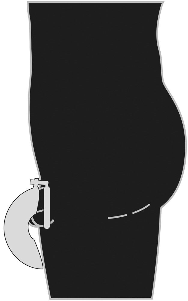 Tegning af mand med penisbur på